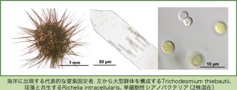 海洋に出現する代表的な窒素固定者. 左から大型群体を構成するTrichodesmium thiebautii、珪藻と共生するRichelia intracellularis、単細胞性シアノバクテリア（2株混在）